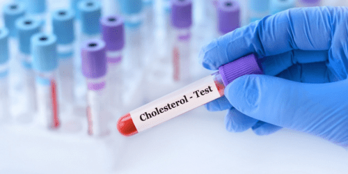 Cholesterol Levels Test