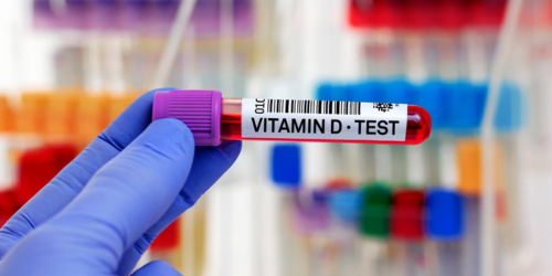 Vitamin Deficiencies Test