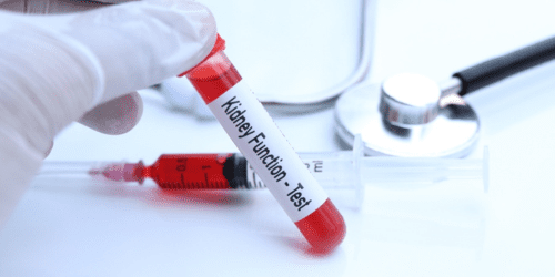 Kidney Function Test