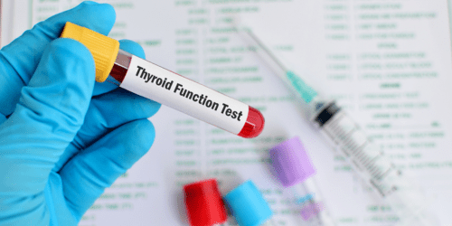 Thyroid Function Test