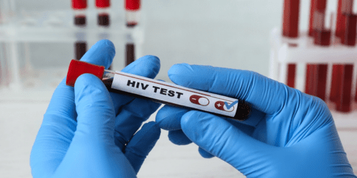 HIV Test