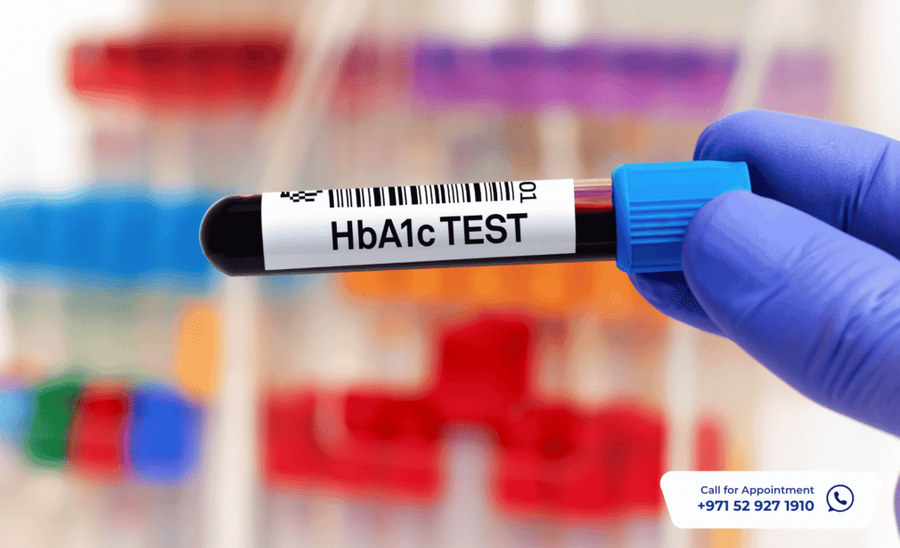 HbA1c Test at Home