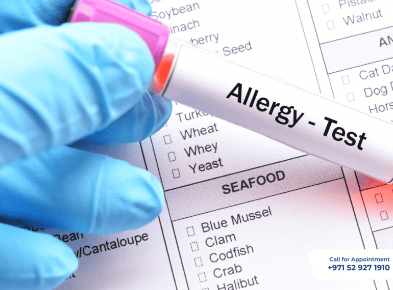 Allergy Test at Home in Dubai
